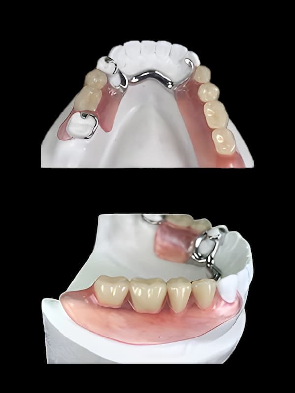 Hybrid Flexible Partial