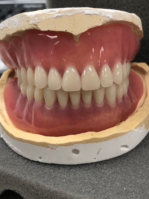 Economy Denture